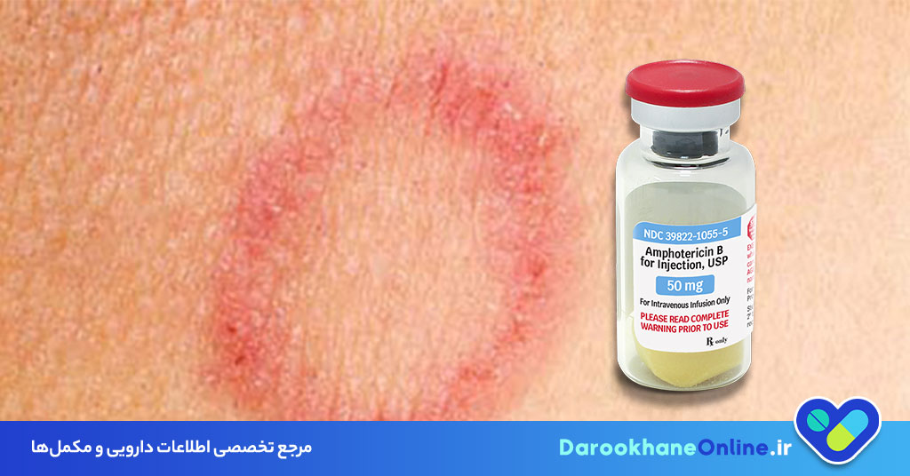 آمفوتریسین بی (Amphotericin B) چیست؟ کاربردها، عوارض و نحوه مصرف داروی ضدقارچی قوی 29 آمفوتریسین بی (Amphotericin B) چیست؟ کاربردها، عوارض و نحوه مصرف داروی ضدقارچی قوی