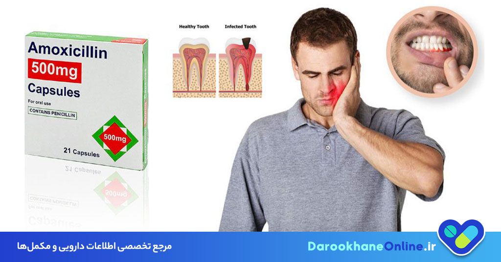 آموکسی سیلین چیست؟ کاربردها، دوز مصرف، عوارض، احتیاط‌ها و تداخل دارویی Amoxicillin