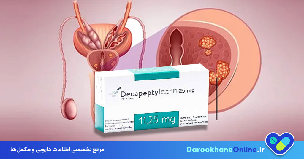 آمپول دکاپپتیل (Decapeptyl) چیست؟ موارد مصرف، نحوه تزریق و عوارض در درمان سرطان پروستات 28 آمپول دکاپپتیل (Decapeptyl) چیست؟ موارد مصرف، نحوه تزریق و عوارض در درمان سرطان پروستات