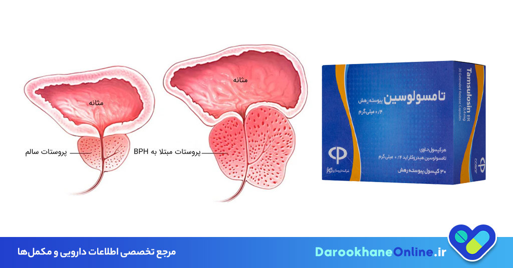تامسولوسین چیست و چه کاربردی در درمان بزرگی پروستات دارد؟ | بررسی کامل اثرات، عوارض و تداخلات دارویی