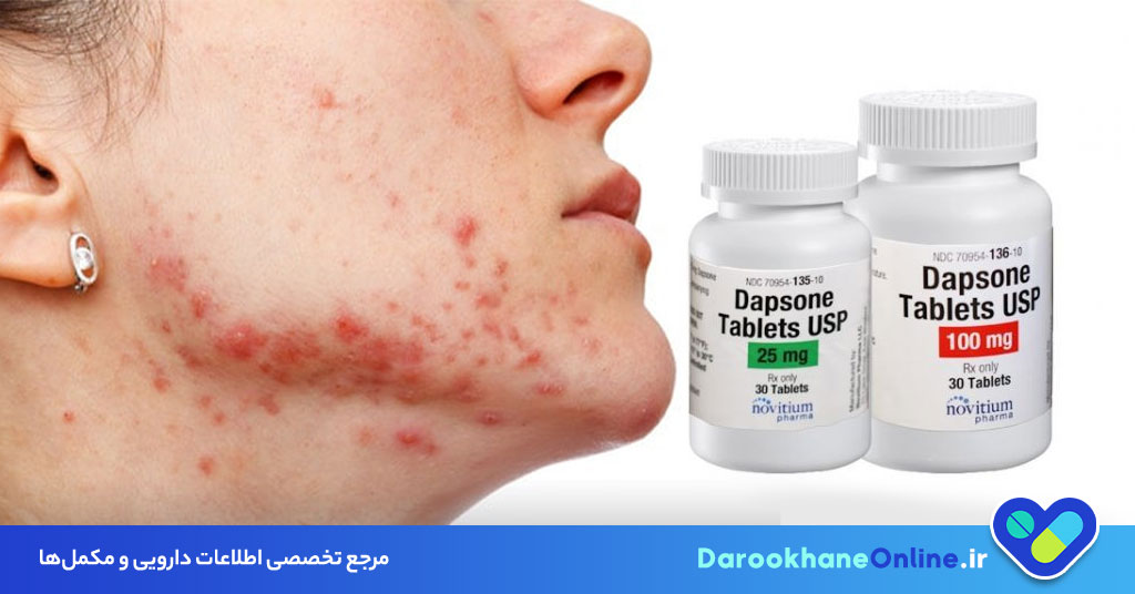 داپسون (Dapsone) چیست؟ کاربرد دارویی، نحوه مصرف، عوارض و نکات مهم برای درمان اختلالات پوستی
