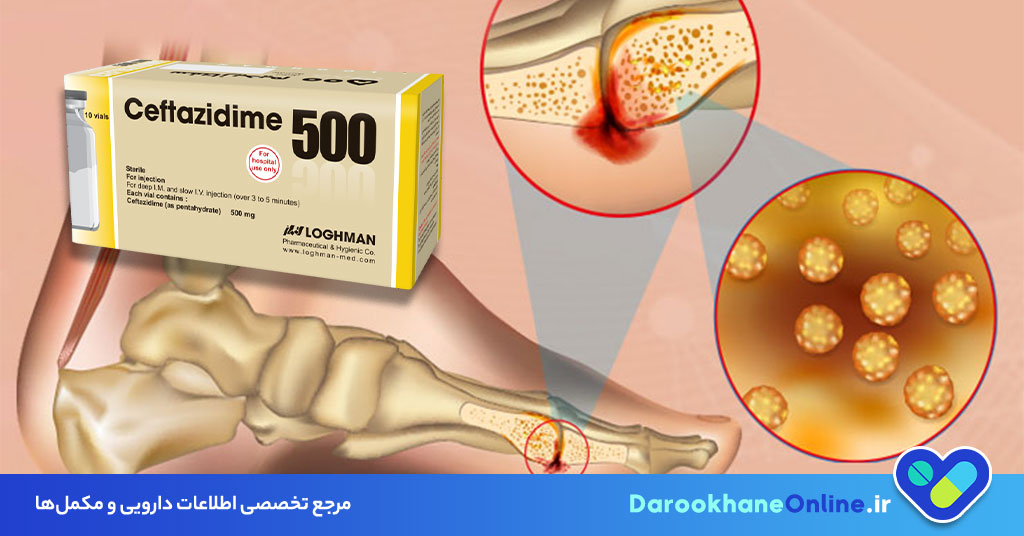 سفتازیدیم (Ceftazidime) چیست؟ موارد مصرف، عوارض، دوز و هشدارهای داروی سفتازیدیم برای درمان عفونتها 29 سفتازیدیم (Ceftazidime) چیست؟ موارد مصرف، عوارض، دوز و هشدارهای داروی سفتازیدیم برای درمان عفونتها