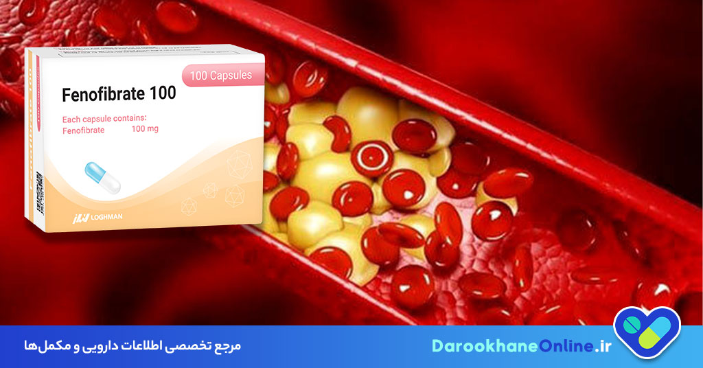 فنوفیبرات چیست و چه کاربردی دارد؟ موارد مصرف، عوارض و تداخلات دارویی قرص فنوفیبرات برای کاهش چربی خون