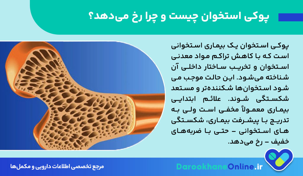 قرص آلندرونیت برای پوکی استخوان: موارد مصرف، عوارض، نحوه مصرف و نکات مهم