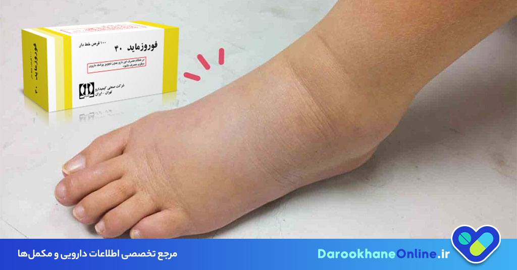 قرص فورزماید (Furosemide) چیست؟ موارد مصرف، عوارض، هشدارها و نحوه مصرف برای درمان ادم و تجمع مایعات 29 قرص فورزماید (Furosemide) چیست؟ موارد مصرف، عوارض، هشدارها و نحوه مصرف برای درمان ادم و تجمع مایعات