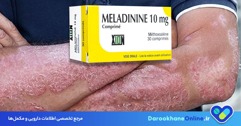 متوکسالن چیست؟ موارد مصرف، عوارض و نحوه درمان بیماری‌های پوستی با متوکسالن و نور UVA