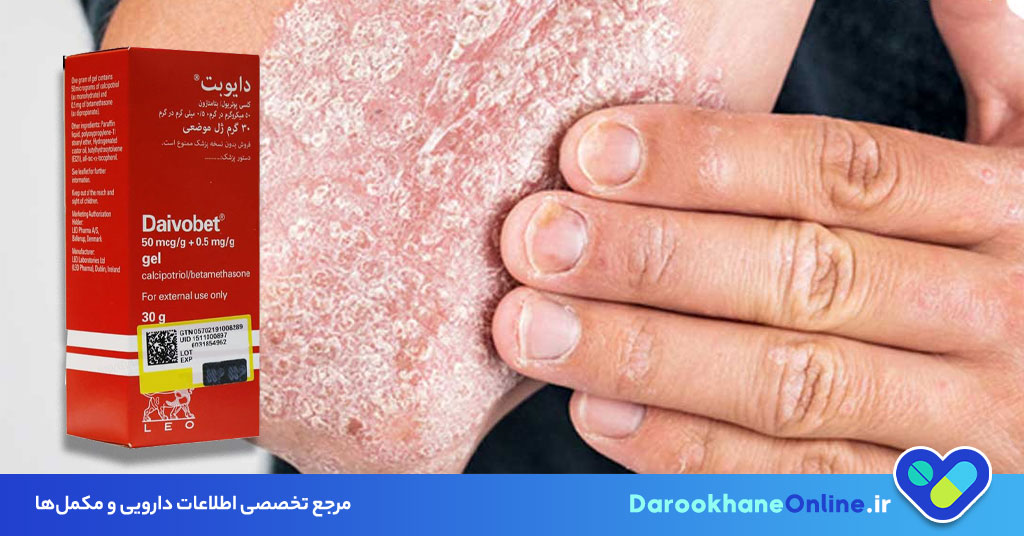 پماد دایوبت (Daivobet)؛ کاربرد، عوارض و نحوه مصرف برای درمان پسوریازیس