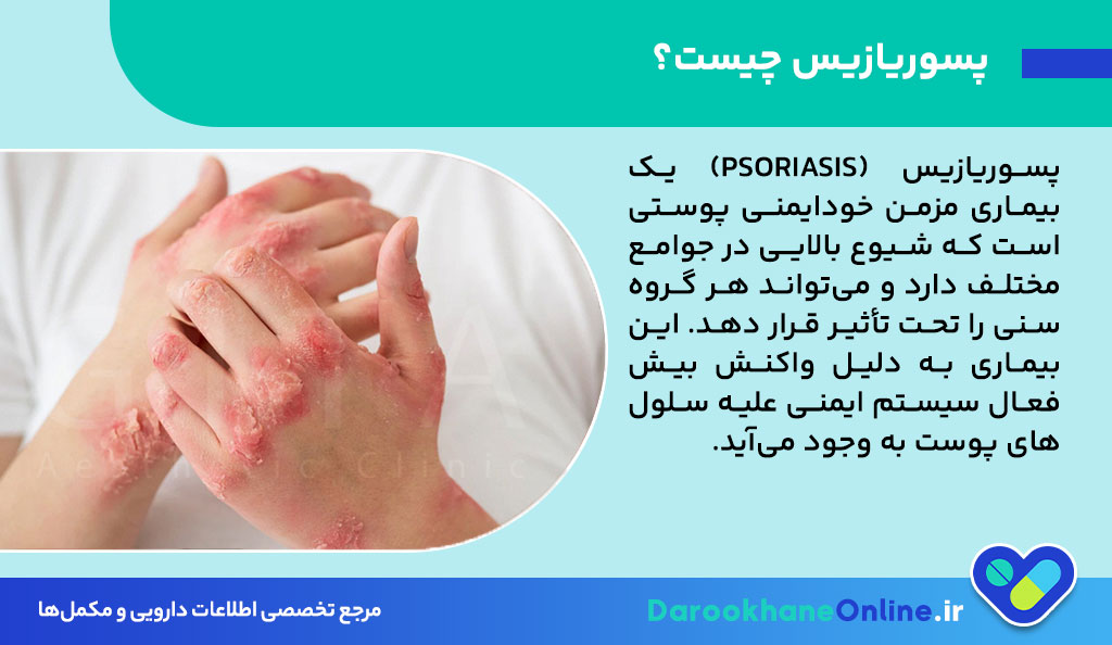 پماد دایوبت (Daivobet)؛ کاربرد، عوارض و نحوه مصرف برای درمان پسوریازیس