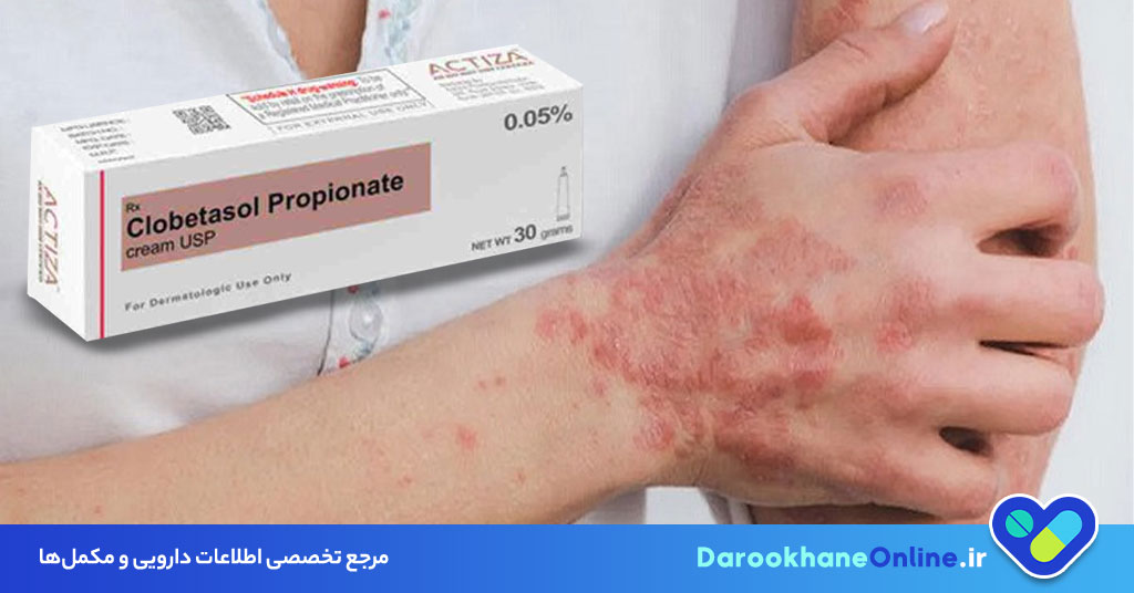 پماد کورتام (Clobetasol) چیست؟ موارد مصرف، عوارض، نحوه مصرف و نکات مهم مصرف پماد کورتام