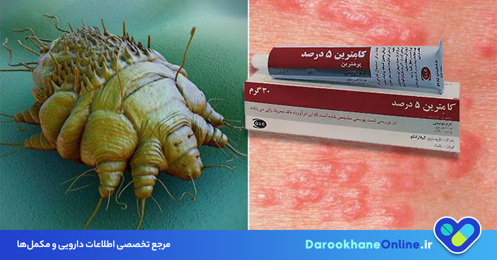 کرم پرمترین برای درمان گال: موارد مصرف، نحوه استفاده، عوارض و نکات مهم 29 کرم پرمترین برای درمان گال: موارد مصرف، نحوه استفاده، عوارض و نکات مهم