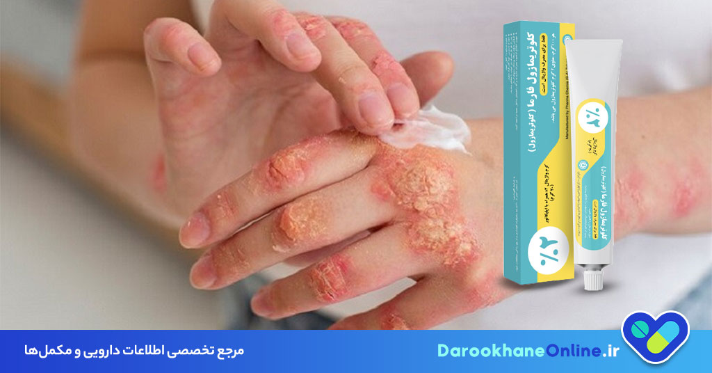کلوتریمازول چیست؟ کاربرد، طریقه مصرف، عوارض و موارد منع مصرف پماد ضدقارچ کلوتریمازول + راهنمای کامل