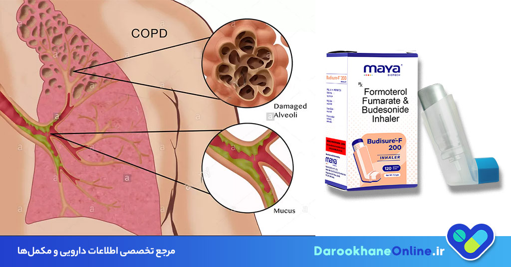اسپری فورموترول: نحوه مصرف، موارد احتیاط و عوارض | درمان آسم و COPD