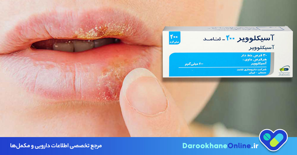 قرص آسیکلوویر چیست و چه کاربردی دارد؟ موارد مصرف، عوارض و نحوه استفاده علمی + تمام نکات مهم