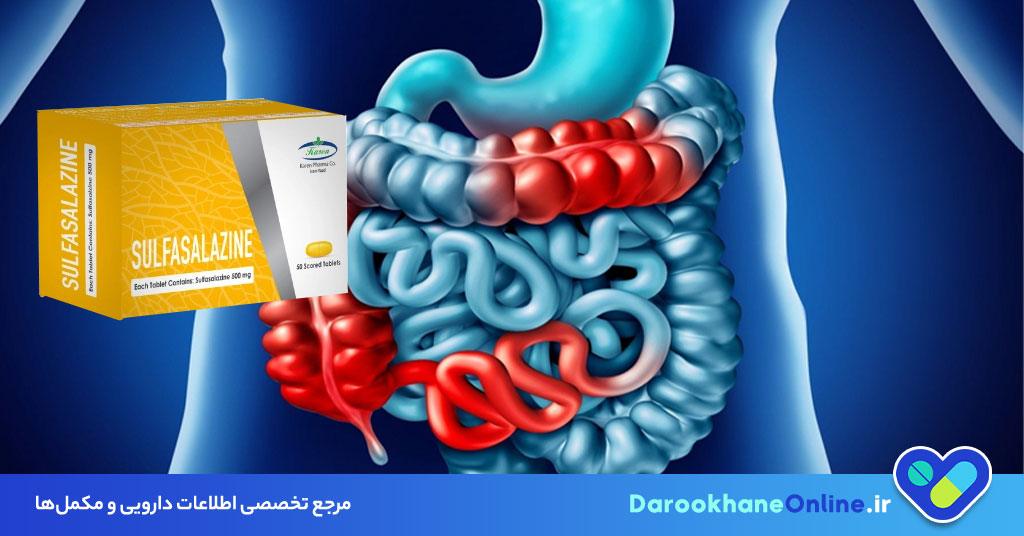 قرص سولفاسالازین؛ کاربرد، نحوه مصرف، عوارض و نکات مهم برای درمان کولیت و روماتیسم