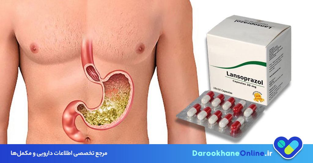 قرص لانسوپرازول؛ درمان موثر رفلاکس معده و زخم گوارشی | موارد مصرف، نحوه استفاده و عوارض