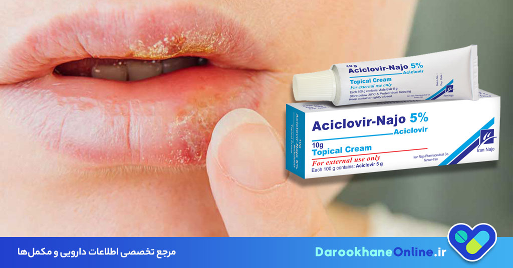 پماد آسیکلوویر برای چیست؟ موارد مصرف، عوارض، طریقه مصرف و نکات مهم برای درمان تبخال