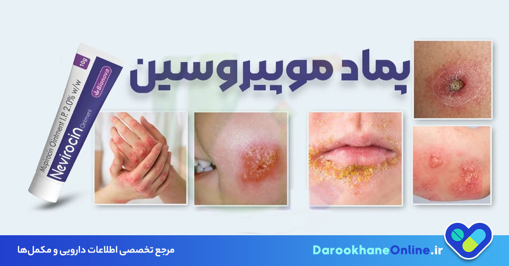 پماد موپیروسین برای چیست؟ کاربردها، روش مصرف و عوارض موپیروسین در درمان عفونت پوستی
