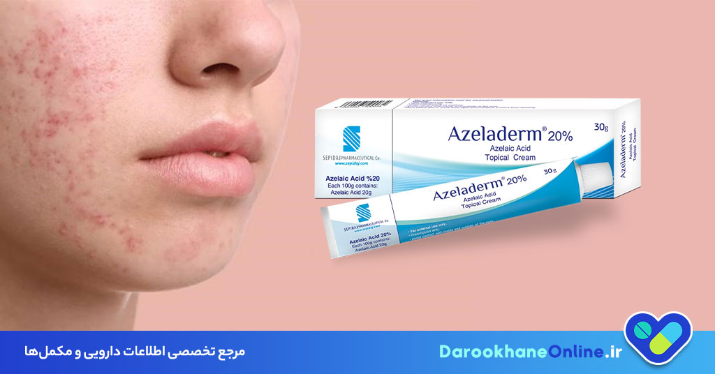کرم آزلادرم برای درمان آکنه و لک صورت | کاربرد، طریقه مصرف و عوارض