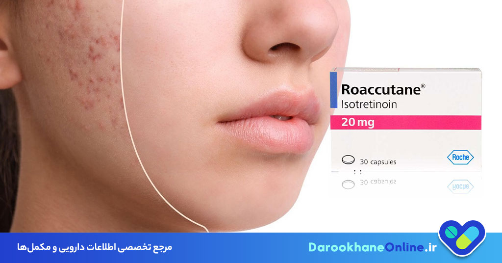 قرص راکوتان چیست و چه کاربردهایی دارد؟ بررسی کامل نحوه مصرف، عوارض و نکات مهم درمان آکنه