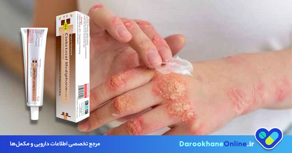 پماد کلوبتازول چیست و چه کاربردی دارد؟ بررسی علمی موارد مصرف، عوارض و نحوه استفاده