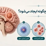 تومور مغزی چگونه ایجاد می‌شود؟