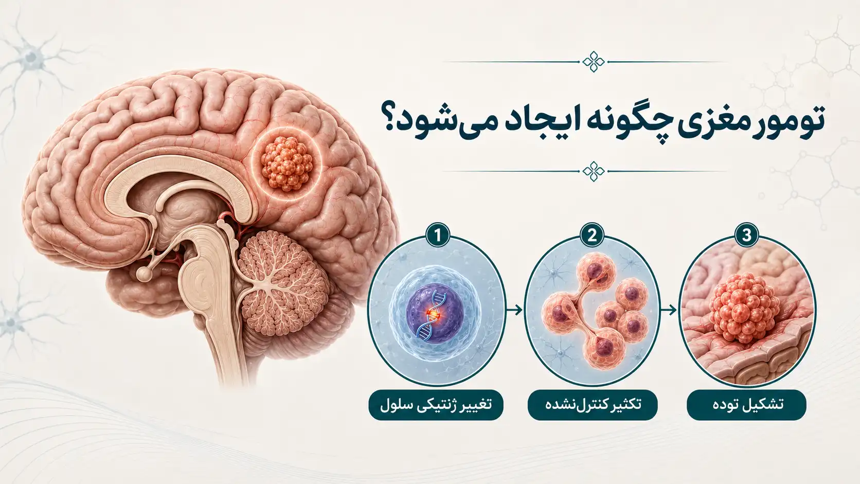 تومور مغزی چگونه ایجاد می‌شود؟