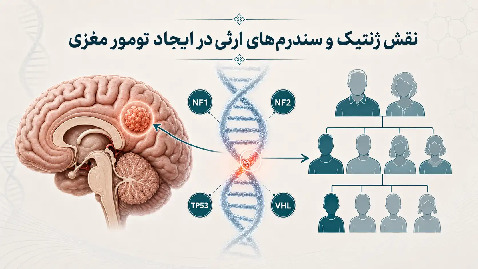 نقش ژنتیک و سندرم‌های ارثی در ایجاد تومور مغزی
